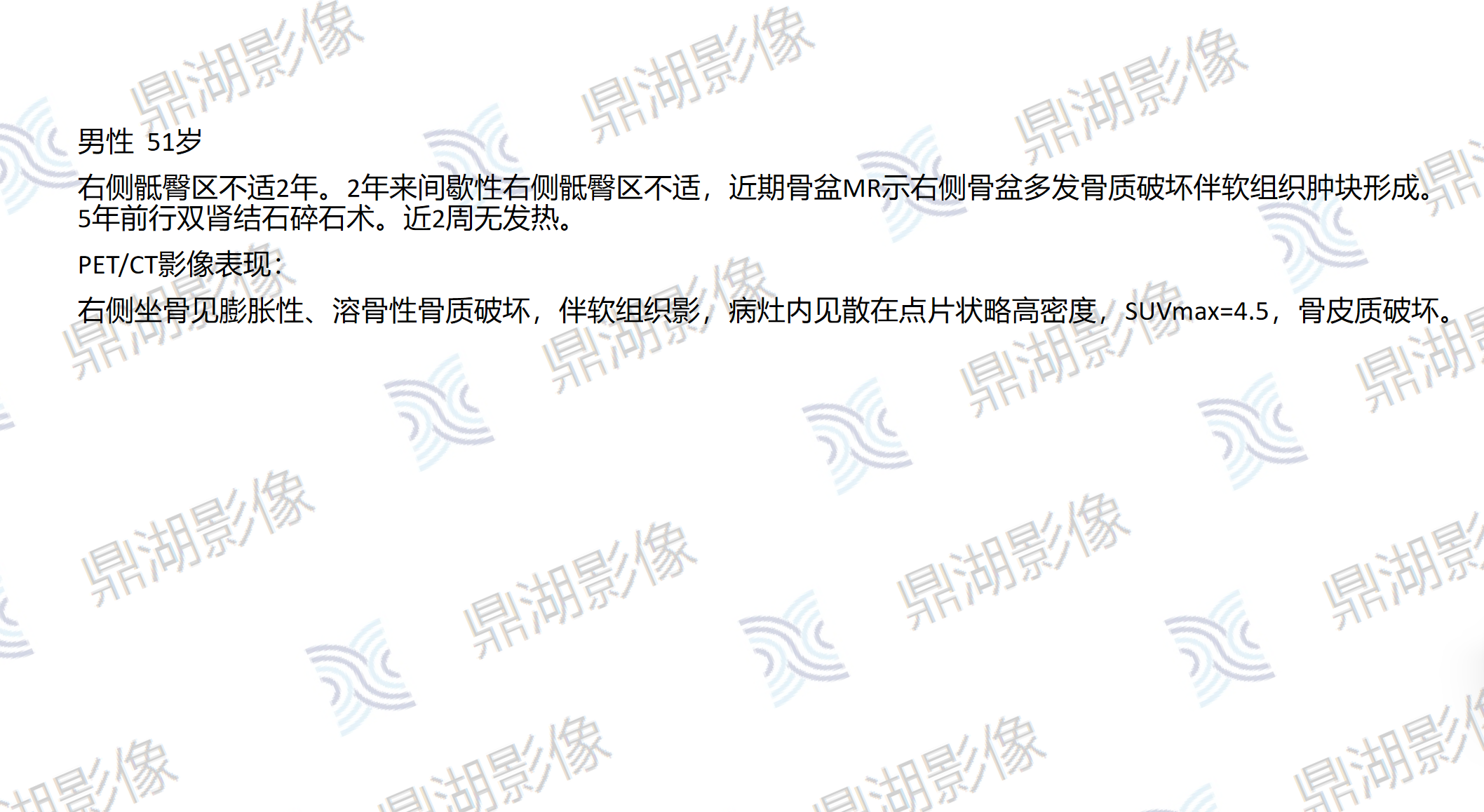dd534c81d574ba5f3fc2cf5de082f373.png